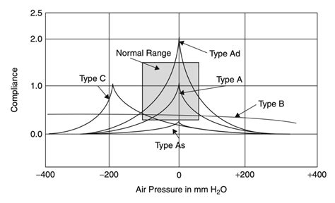 how to read a tympanogram|Tympanometry: An Introduction .
